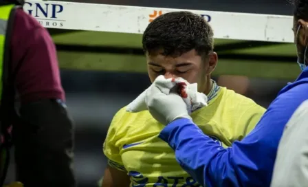 América: Así quedó Zendejas tras sufrir fractura en la nariz