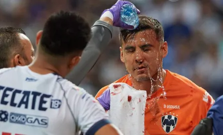 Luis Cárdenas muestra escalofriantes fotos de su fractura de nariz tras el Rayados vs Santos 