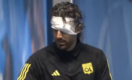 Fabio Grosso acaba ensangrentado tras agresión de ultras; Marsella vs Lyon fue suspendido