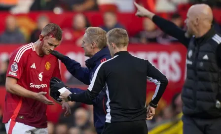 Matthijs de Ligt sufrió aparatosa herida en el partido de Manchester United contra Brentford