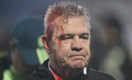 Javier Aguirre terminó ensangrentado tras "agresión" de la afición de Honduras