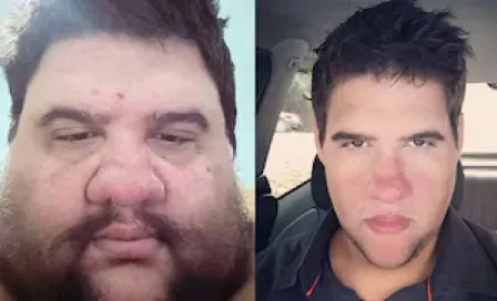 Muere el influencer Gabriel Freitas de un infarto fulminante; había perdido 200 kilos