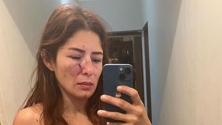 La luchadora Daniela López Mejía denunció que fue golpeada por el padre de sus hijas