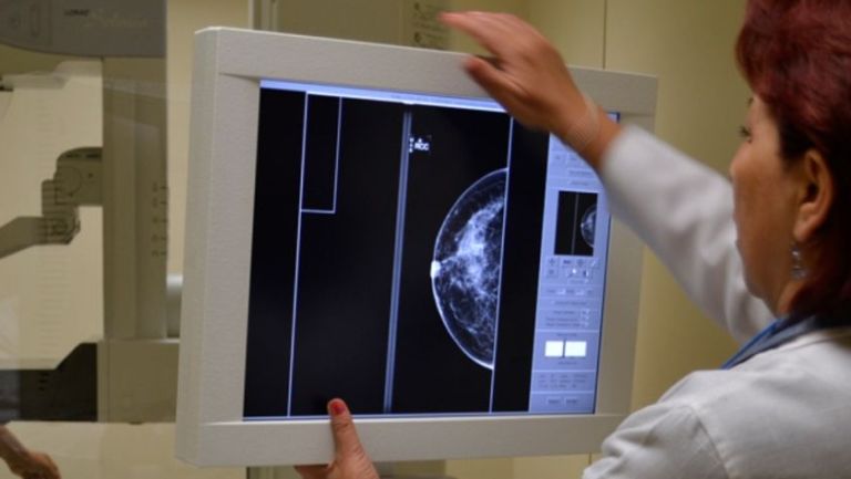 Sudor, nuevo método para detectar cáncer de mama