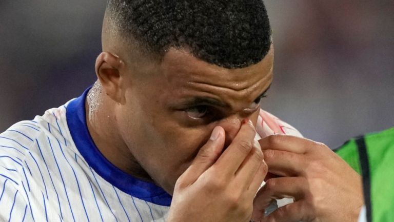 ¡Escalofriante! Así quedó la nariz de Kylian Mbappé; el astro francés sufrió una fractura